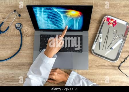 Top view of Doctor showing a x-ray of pain in the shoulder on a laptop. Stock Photo