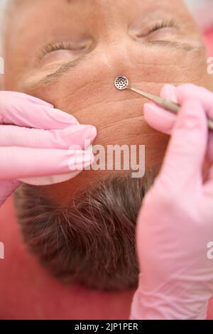 Beautician female hands with uno spoon clean forehead skin Stock Photo