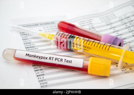 Blood tests for monkeypox virus, yellow syringe and blood test tubes on the paper of test results Stock Photo