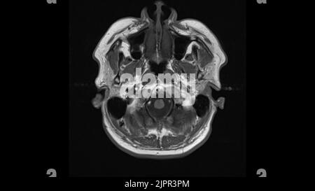 Healthy head, MRI scan Stock Photo