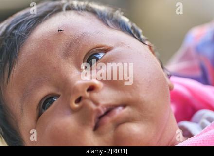 A mosquito on a babys forehead. Stock Photo