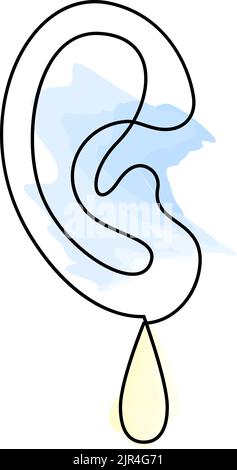 Ear with drop continuous line drawing. Ear infection. Inflammation and fluid buildup. Otitis media. Hearing loss. Vector illustration. Stock Vector
