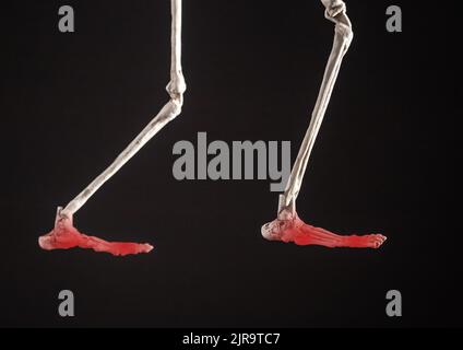 Human skeleton legs with painful feet with red point on black background. Profile view. Injury, overuse, bones inflammation. Bunions, metatarsalgia, fracture, tendonitis. High quality photo Stock Photo
