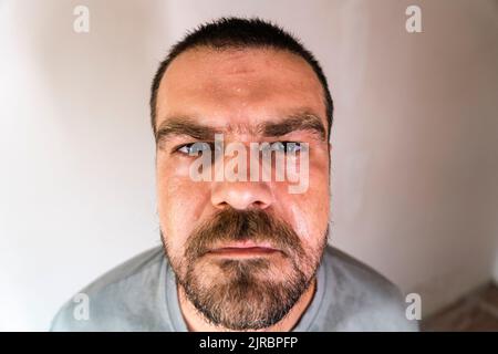 Selective focus, close up, high angle view shot of a caucasian bearded man with sweaty face. Stock Photo