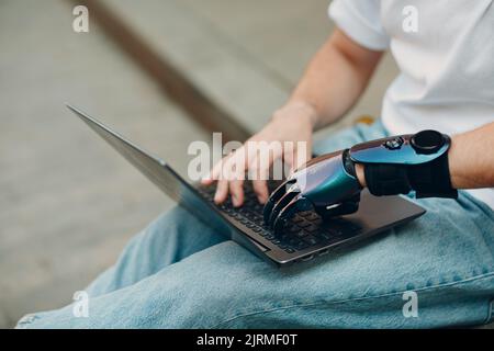 Young disabled man with artificial prosthetic hand using typing on laptop computer keyboard Stock Photo