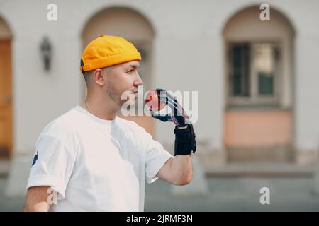 Young disabled man hold apple with artificial prosthetic hand in casual clothes Stock Photo