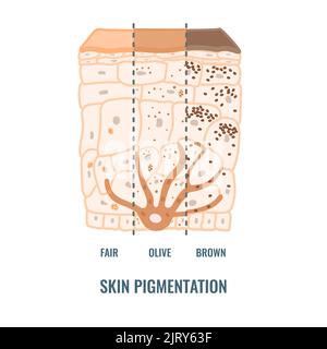 Skin pigmentation, illustration Stock Photo