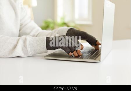 Man with rheumatoid arthritis types text on laptop wearing special compression gloves. Stock Photo