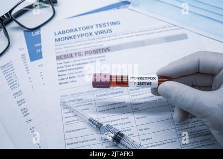 Blood collection tubes and data sheet on monkeypox test positive ...