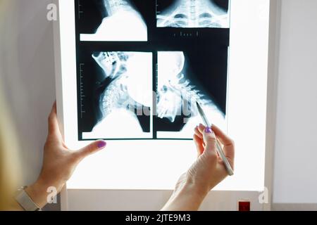 Close up view of doctor hand with pen pointing at x-ray image of neck Stock Photo