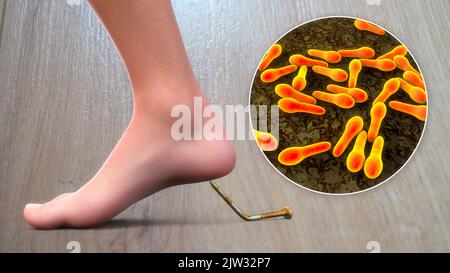 Infection transmission. Conceptual illustration showing an old rusty metal nail as a source of tetanus or other anaerobic bacterial infections. Stock Photo