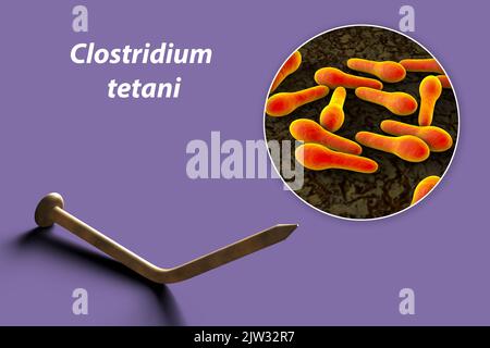 Transmission of tetanus bacteria. Conceptual illustration showing an old rusty metal nail as a source of infection and a close-up view of Clostridium tetani bacteria, the cause of tetanus. Stock Photo