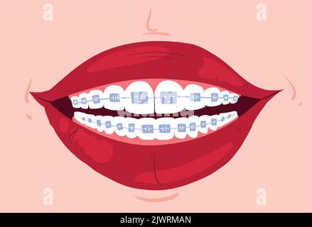 Clean teeth with mouthwash in flat design. Smiling teeth cartoon dental care. Oral healthcare with mouthwash for plaque prevention and fresh breath. Stock Vector