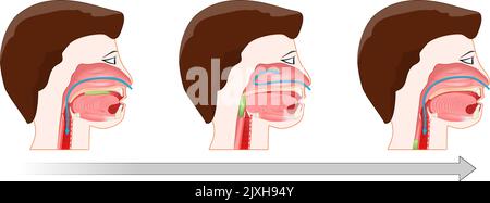 Swallowing. Process of deglutition. After form the bolus, food is ready to be swallowed. The soft palate elevated to close the nasopharynx, Epiglottis Stock Vector
