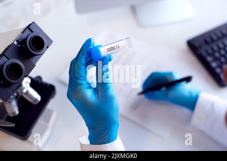 Close Up Of Lab Worker Doing Test Using Microscope Holding Test Tube Labelled Positive And Negative Stock Photo