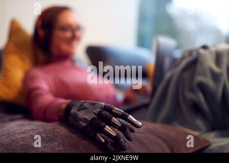 Woman With Prosthetic Arm Wearing Wireless Headphones And Working On Laptop On Sofa At Home Stock Photo