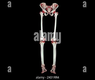 CT Scan of knee 3D rendering image isolated on black background for ...