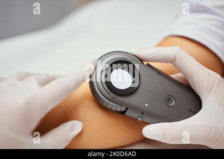 A dermatologist examines the skin. Stock Photo