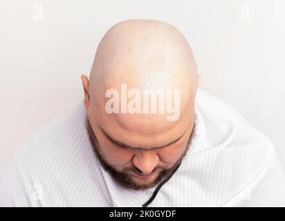 before and after bald head of a man. bald head of a man, shaving bald in a barber shop. Stock Photo