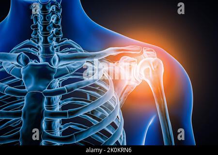 Anterior or front view of human shoulder joint and bones with inflammation 3D rendering illustration. Pathology, articular pain, anatomy, osteology, r Stock Photo