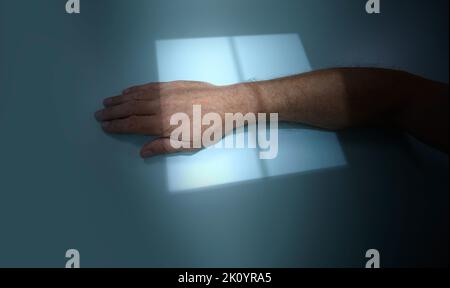 X-ray hand, close-up. patient with wrist injury during x-ray procedure in hospital Stock Photo