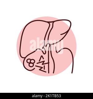 Cholelithiasis liver color line icon. Human diseases. Pictogram for web page, mobile app, promo. Stock Vector