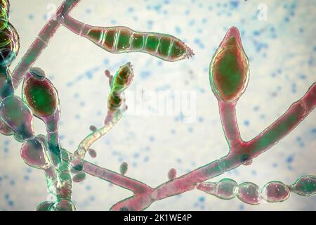 Microsporum audouinii fungus, illustration Stock Photo