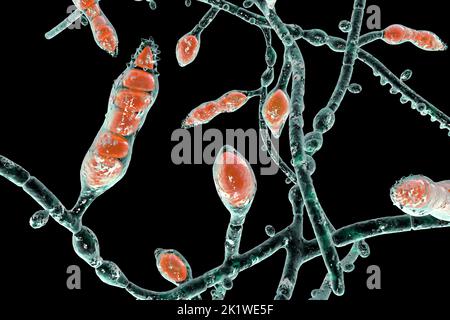 Microsporum audouinii fungus, illustration Stock Photo