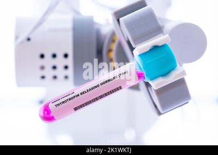 Thyrotropin releasing hormone, conceptual image Stock Photo