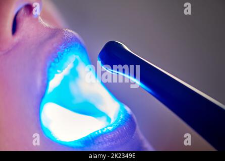 Getting a better view. a dentist examining a girls mouth with a ultraviolet light. Stock Photo