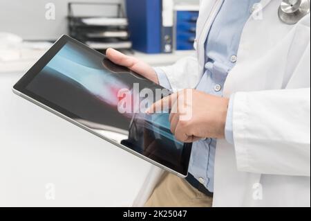 Unrecognizable Doctor is checking x-ray image at computer tablet, close up. Doctor at work in a hospital. Medicine and healthcare concept. High qualit Stock Photo