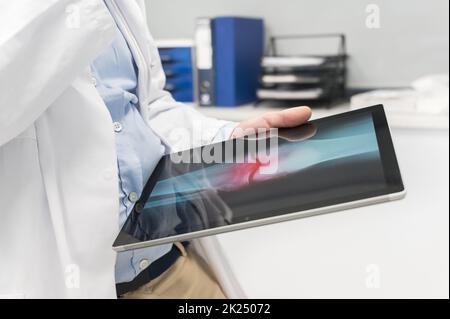 Unrecognizable Doctor is checking x-ray image at computer tablet, close up. Doctor at work in a hospital. Medicine and healthcare concept. High qualit Stock Photo