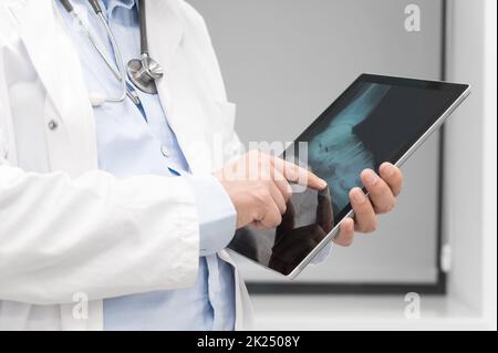 Unrecognizable Doctor is checking x-ray image at computer tablet, close up. Doctor at work in a hospital. Medicine and healthcare concept. High qualit Stock Photo