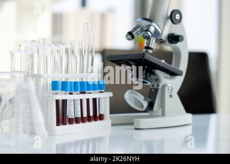 Blood collection tubes from covid 19 patients place next to microscope on white laboratory table. Coronavirus disease 2019 testing process in a laboratory preventing the spread of viral research. Stock Photo