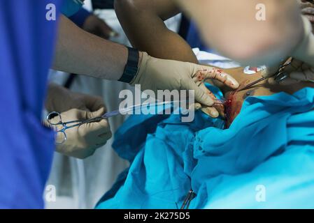 Intubating his patient's chest. Cropped shot of a doctor inserting a tube into a patients chest in an emergency room. Stock Photo