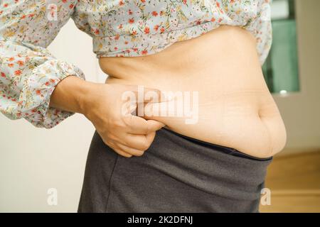 Overweight Asian woman show and use hand to squeeze fat belly. Stock Photo