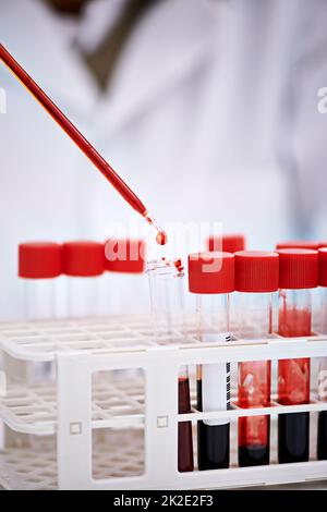 Taking a closer look at your blood. Cropped shot of a scientist working with blood samples in the lab. Stock Photo