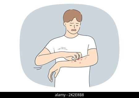 Unhappy man suffer from allergy or psoriasis Stock Photo