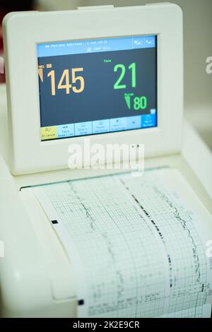 Ready for your recovery. Shot of monitoring equipment in an empty hospital ward. Stock Photo