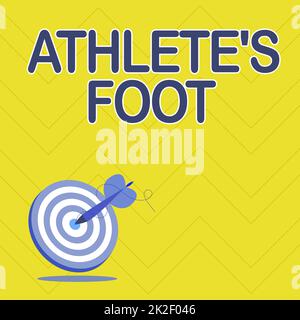 Handwriting text Athlete S Is Foot. Business approach a fungus infection of the foot marked by blisters Presenting Message Hitting Target Concept, Abstract Announcing Goal Stock Photo