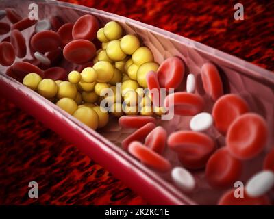 Fat cells blocking the blood flow inside human vein. 3D illustration Stock Photo