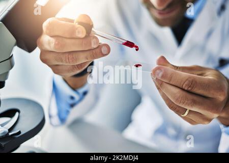 These will need further examining. Shot of a scientist analyzing medical samples in a lab. Stock Photo