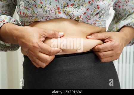 Overweight asian woman use hand to squeeze fat belly big size overweight and obesity. Stock Photo