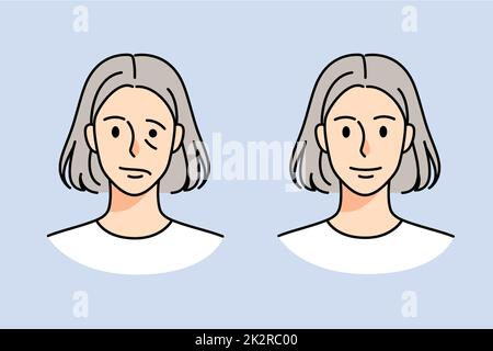 Old woman struggle with facial nerve palsy Stock Photo
