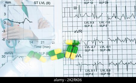 EKG or ECG graph report paper. EST result and green-yellow capsule pills with cardiologist specialist doctor wear white uniform. Physician stand with arms crossed and hand holding stethoscope. Stock Photo
