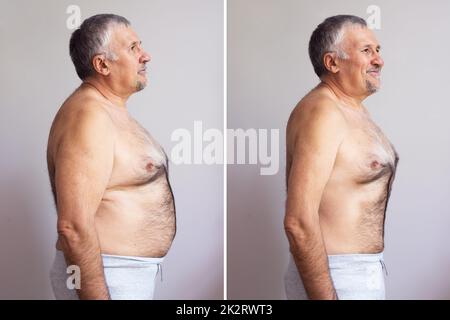 Man Before And After Loosing Fat Stock Photo