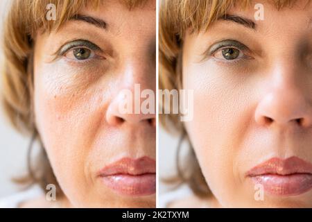 Woman With Before And After Rejuvenation Stock Photo