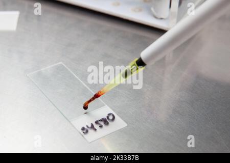 Bone Marrow Smear Preparationin The Laboratory Blood Smear