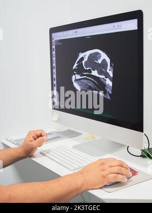 Unrecognizable person on computer looking at x-ray in a lab of modern hospital Stock Photo