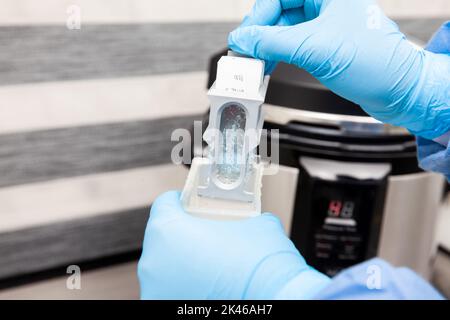 Scientist preparing slides with tissue samples for immunohistochemistry assay in the laboratory. Scientist at the Immunohistochemistry laboratory carr Stock Photo